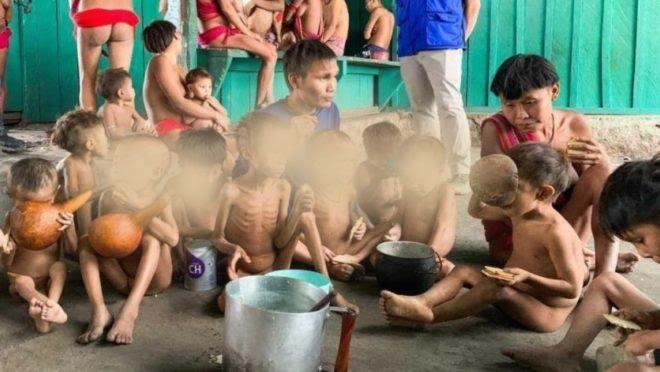 Deputado venezuelano diz que yanomamis desnutridos vieram do seu país para o Brasil